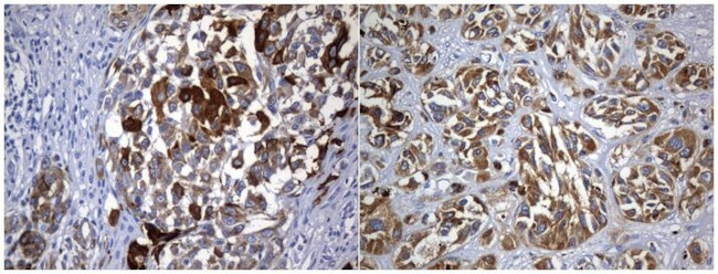 TYR Antibody in Immunohistochemistry (Paraffin) (IHC (P))