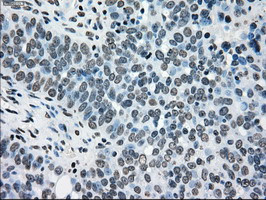 TYRO3 Antibody in Immunohistochemistry (Paraffin) (IHC (P))