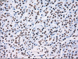 TYRO3 Antibody in Immunohistochemistry (Paraffin) (IHC (P))