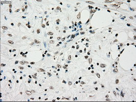 TYRO3 Antibody in Immunohistochemistry (Paraffin) (IHC (P))