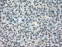 TYRO3 Antibody in Immunohistochemistry (Paraffin) (IHC (P))