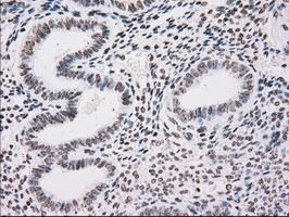 TYRO3 Antibody in Immunohistochemistry (Paraffin) (IHC (P))