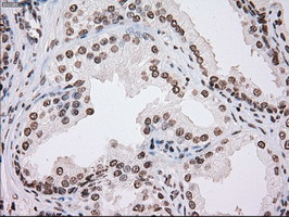 TYRO3 Antibody in Immunohistochemistry (Paraffin) (IHC (P))