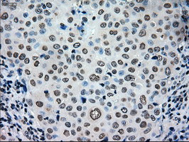 TYRO3 Antibody in Immunohistochemistry (Paraffin) (IHC (P))