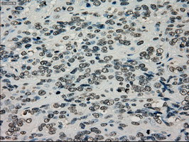 TYRO3 Antibody in Immunohistochemistry (Paraffin) (IHC (P))