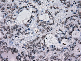 TYRO3 Antibody in Immunohistochemistry (Paraffin) (IHC (P))