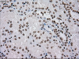 TYRO3 Antibody in Immunohistochemistry (Paraffin) (IHC (P))