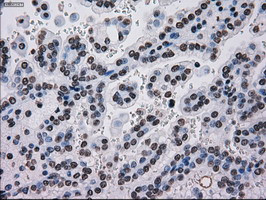 TYRO3 Antibody in Immunohistochemistry (Paraffin) (IHC (P))