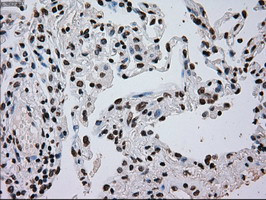 TYRO3 Antibody in Immunohistochemistry (Paraffin) (IHC (P))