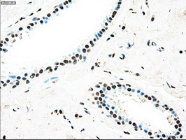 TYRO3 Antibody in Immunohistochemistry (Paraffin) (IHC (P))