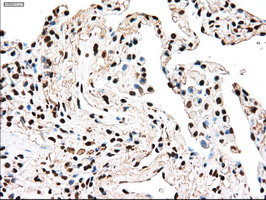 TYRO3 Antibody in Immunohistochemistry (Paraffin) (IHC (P))