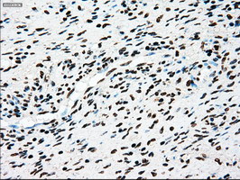 TYRO3 Antibody in Immunohistochemistry (Paraffin) (IHC (P))