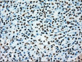 TYRO3 Antibody in Immunohistochemistry (Paraffin) (IHC (P))