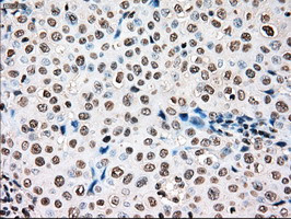 TYRO3 Antibody in Immunohistochemistry (Paraffin) (IHC (P))