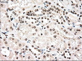 TYRO3 Antibody in Immunohistochemistry (Paraffin) (IHC (P))