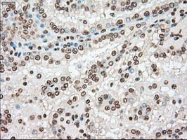 TYRO3 Antibody in Immunohistochemistry (Paraffin) (IHC (P))