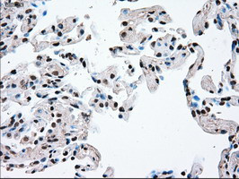 TYRO3 Antibody in Immunohistochemistry (Paraffin) (IHC (P))