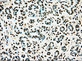 TYRO3 Antibody in Immunohistochemistry (Paraffin) (IHC (P))