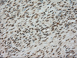 TYRO3 Antibody in Immunohistochemistry (Paraffin) (IHC (P))