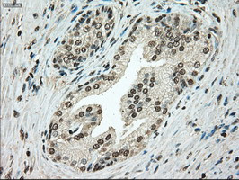 TYRO3 Antibody in Immunohistochemistry (Paraffin) (IHC (P))