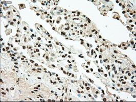 TYRO3 Antibody in Immunohistochemistry (Paraffin) (IHC (P))