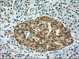 TYRO3 Antibody in Immunohistochemistry (Paraffin) (IHC (P))