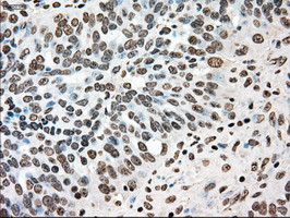 TYRO3 Antibody in Immunohistochemistry (Paraffin) (IHC (P))