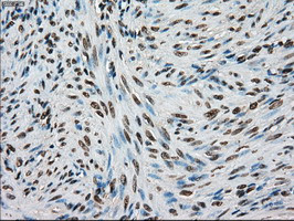 TYRO3 Antibody in Immunohistochemistry (Paraffin) (IHC (P))