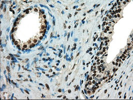 TYRO3 Antibody in Immunohistochemistry (Paraffin) (IHC (P))