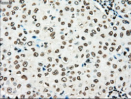 TYRO3 Antibody in Immunohistochemistry (Paraffin) (IHC (P))