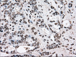 TYRO3 Antibody in Immunohistochemistry (Paraffin) (IHC (P))