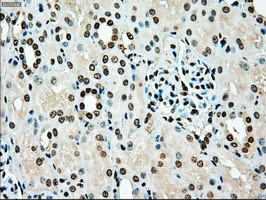 TYRO3 Antibody in Immunohistochemistry (Paraffin) (IHC (P))