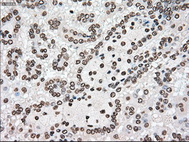 TYRO3 Antibody in Immunohistochemistry (Paraffin) (IHC (P))