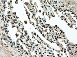 TYRO3 Antibody in Immunohistochemistry (Paraffin) (IHC (P))