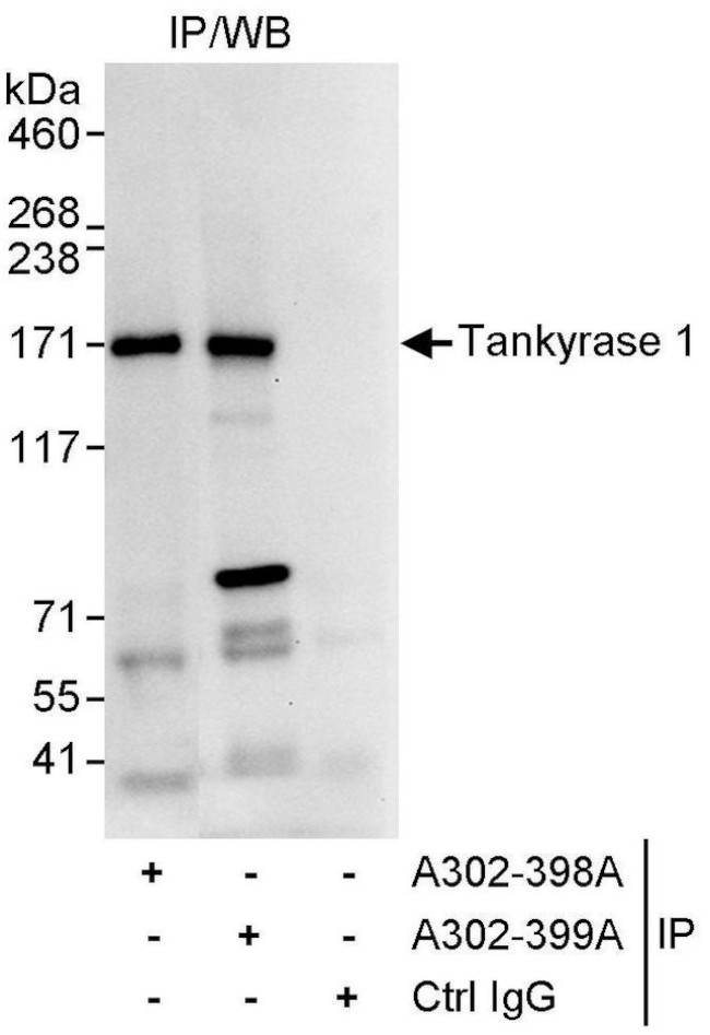 Tankyrase 1 Antibody in Immunoprecipitation (IP)