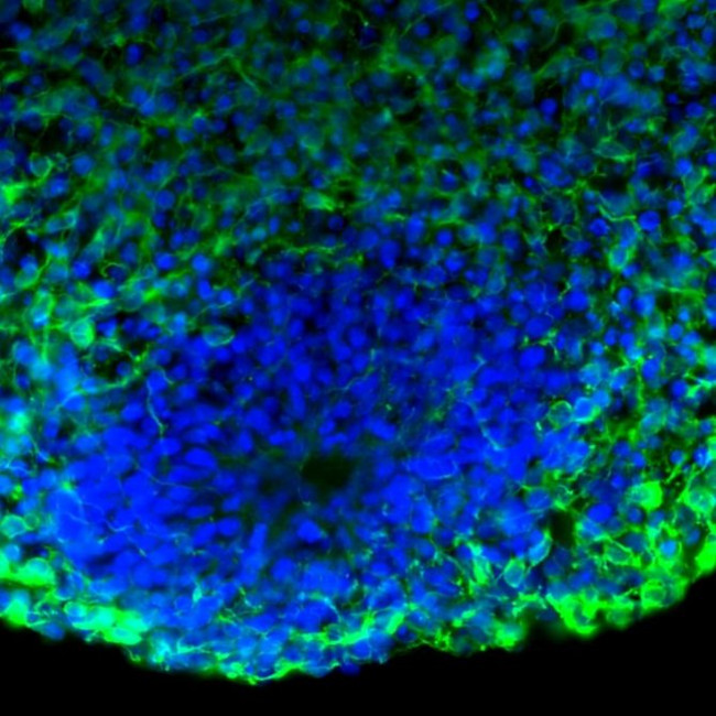 Tau Antibody in Immunohistochemistry (Frozen) (IHC (F))