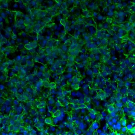 Tau Antibody in Immunohistochemistry (Frozen) (IHC (F))