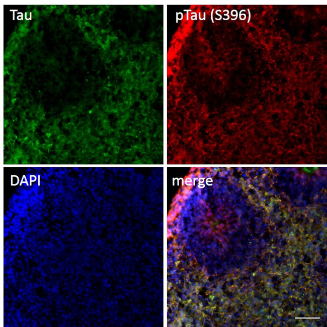 Tau Antibody in Immunohistochemistry (Frozen) (IHC (F))