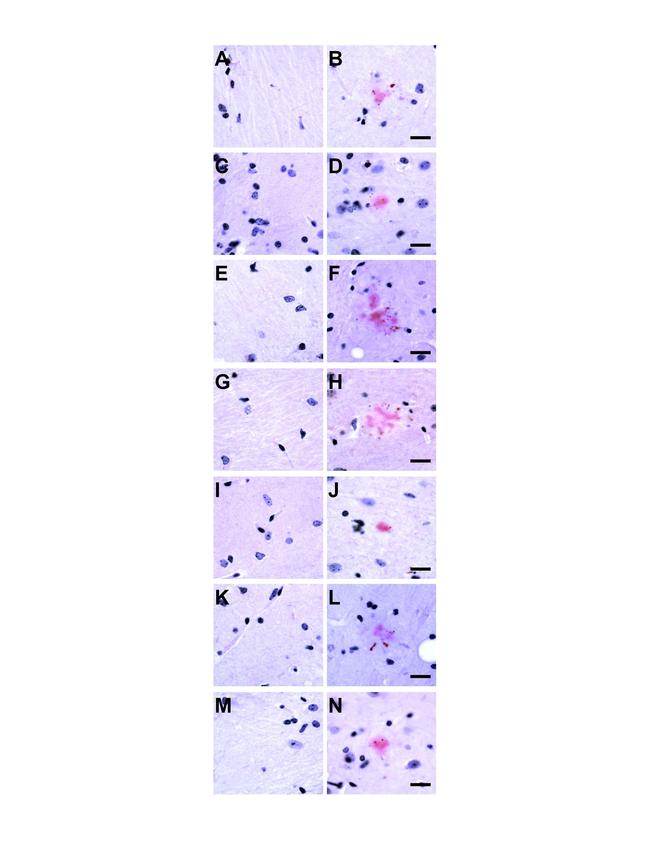 Phospho-Tau (Ser202, Thr205) Antibody in Immunohistochemistry (IHC)