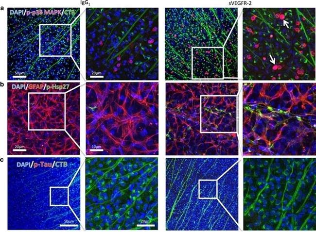 Phospho-Tau (Ser202, Thr205) Antibody in Immunohistochemistry (IHC)