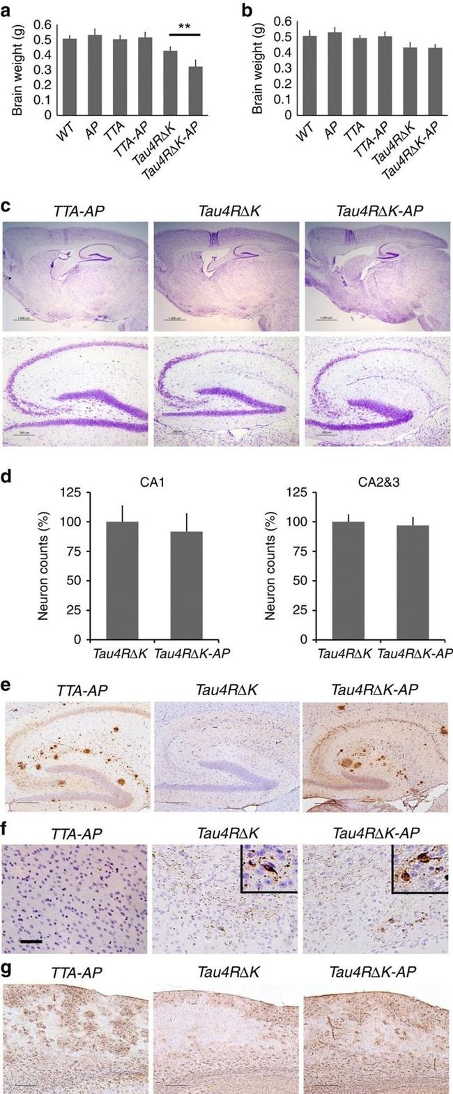 Phospho-Tau (Ser422) Antibody in Immunohistochemistry (Paraffin) (IHC (P))