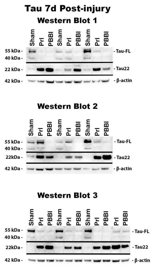 Tau (Cleaved Asp421, Asp422) Antibody in Western Blot (WB)