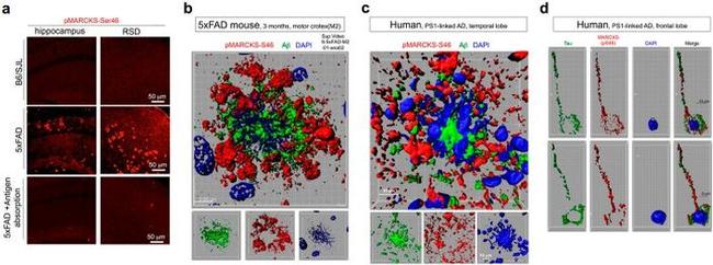 Tau Antibody in Immunohistochemistry (Paraffin) (IHC (P))