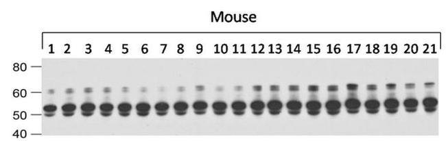 Tau Antibody in Western Blot (WB)