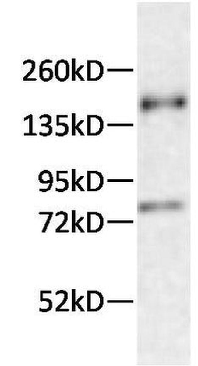 Tau Antibody in Western Blot (WB)