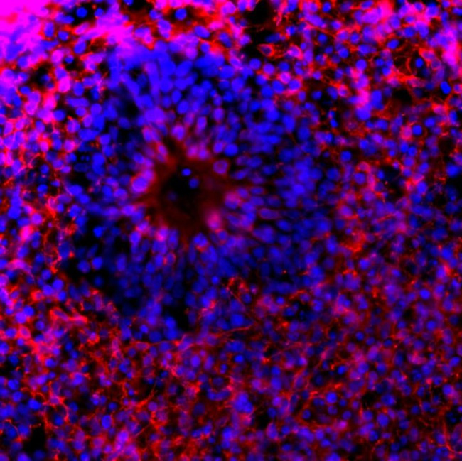 Phospho-Tau (Ser396) Antibody in Immunohistochemistry (Frozen) (IHC (F))