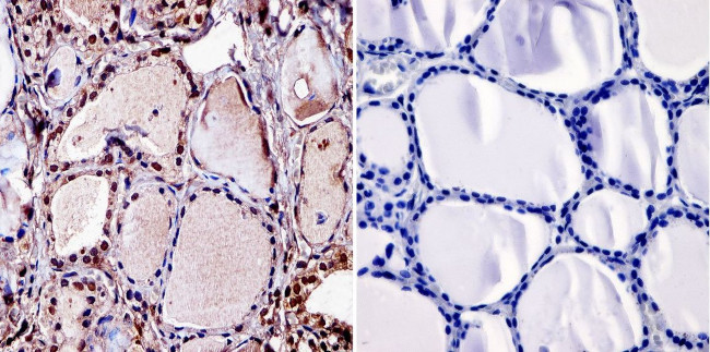 THRB Antibody in Immunohistochemistry (Paraffin) (IHC (P))