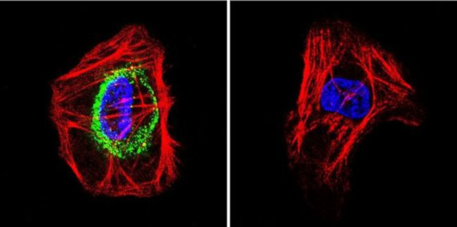 TSH Receptor Antibody in Immunocytochemistry (ICC/IF)