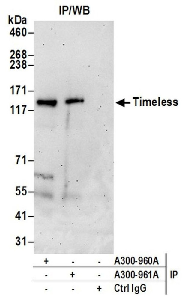 Timeless Antibody in Immunoprecipitation (IP)