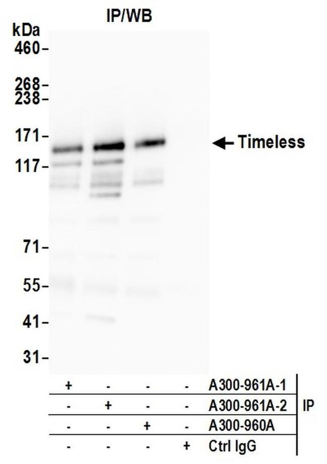 Timeless Antibody in Western Blot (WB)